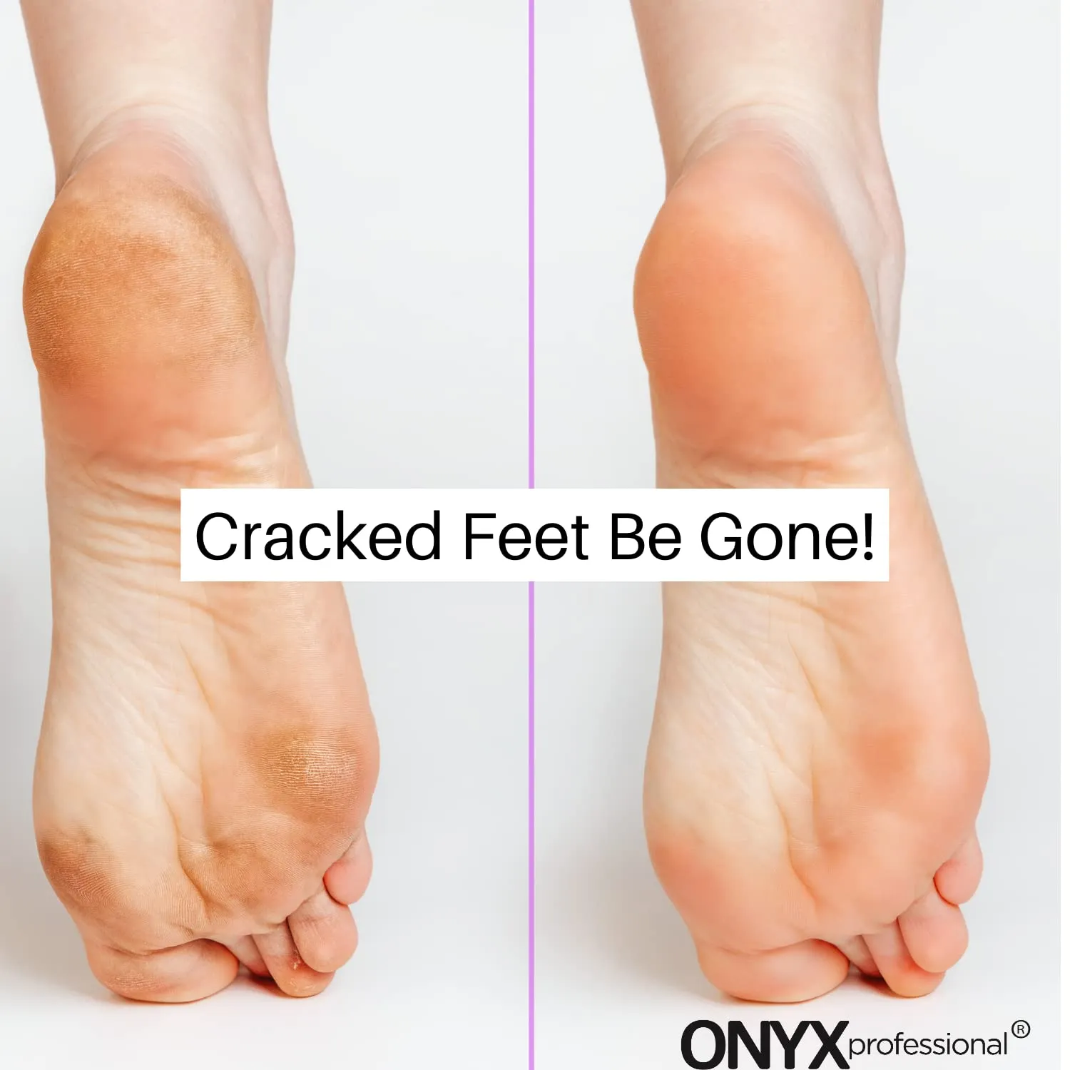 Onyx Professional Gel Moisturizing Socks, One Size Dry Feet Treatment for Women or Men, Hydrating Spa Socks for Dry Feet and Cracked Heel Repair, One Reusable Pair